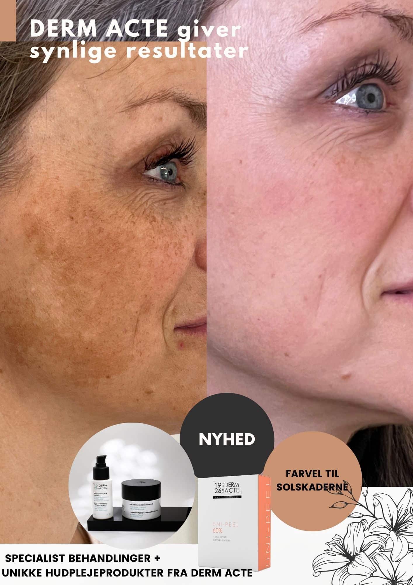 Kursus: Grundkursus Derm acte produkter og behandlinger, Roskilde 19. Maj 2026