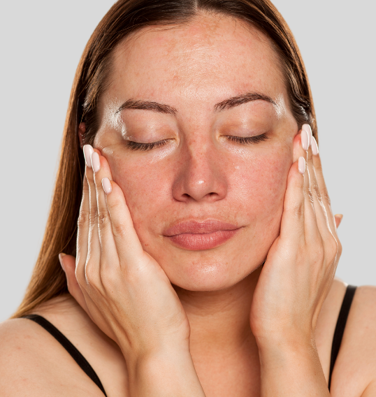 Kostplan til fedtet hud